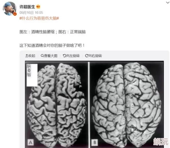 炉石传说国服2024年疲劳术卡组全新玩法攻略与构筑技巧